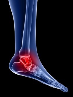 ankle blue