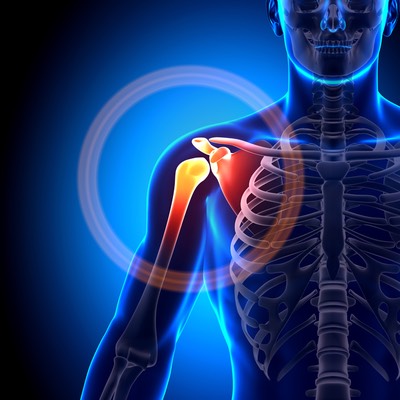 Shoulder-pain-skeleton